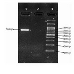 Figure 1. Electrophoresis of the PCR product of exon 10 (Lane 1: PCR product, Lane 2: no template control (NTC), Lane 3: 100 bp DNA ladder)