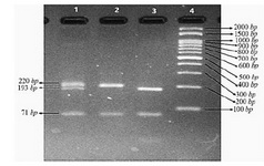 Figure 3. Electrophoresis of three samples after digestion with PVUII. (Lane 1: heterozygote for the 6bp insertion, Lane 2: no insertion, Lane 3: homozygote for the 6bp insertion, Lane 4: 100 bp DNA ladder)