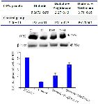 Figure 1.&nbsp; Comparison of OPN protein levels in the rat endometrium at the time of embryo implantation. All values were presented as mean&plusmn;SEM. Error bars represent standard error of mean.&nbsp; p&lt;0.05 was considered statistically significant. Data analysis reveals that significant differences were observed be-tween all four groups. In western blot image, D=diabetic control, C=control group, D+P=diabetic rats treated with pioglitazone and D+M=diabetic rats treated with metformin
