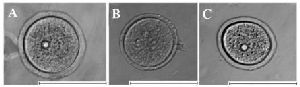 Figure 4. Photo of typical oocytes from three different groups: A&ndash;oocytes obtained from mature mice (3 months), B&ndash;oocytes obtained from immature mice (3 weeks), C&ndash;oocytes isolated from ovarian follicles cultured for 8 days in alginate hydrogel. The scale bar is 100 &mu;m