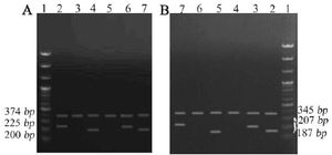 Figure 1. Electrophoresis of tetra-ARMS PCR products to determine the genotype of rs1484215 and rs6495096 in CYP11A1 gene.
A: (rs6495096): Lane 1: DNA ladder (100 bp); Lane 2 and 3: homozygous genotype (GG); Lane 4 and 5: homozygous genotype (CC); Lane 6 and 7: heterozygous genotypes (GC)
B: (rs1484215): Lane 1: DNA ladder (100 bp); Lane 2 and 3: heterozygous genotypes (TC); Lane 4 and 5: homozygous genotype (TT); Lane 6 and 7: homozygous genotype (CC)
