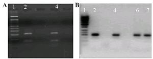 Figure 1. Detection of HPV genotype by PCR in semen cases. Gel figure A shows the presence of HPV 18 infection with an amplicon of E6 consensus (208 bp) and gel figure B represents the amplicon of HPV 16 E7 (196 bp). A: Results of PCR HPV 18 genotype. Lines 2 and 4 were HPV 18 positive. B: 2, 4, 6 and 7 cases are positive for HPV 16. Molecular weight marker for A is 100 bp and for B is 50 bp