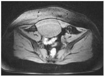 Figure 1. MRI view