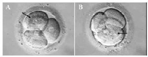 Figure 2. A) Two nuclei in a blastomere (black arrow); B) Multiple nuclei in a blastomere (black arrow)