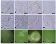 Figure 3. The intensity reactions of rat oocytes fed Anethum graveolens seed extracts that stained with different lectins. Oocyte after staining with UEA is shown in A: Sham group; B: Control group; C: Low dose of seed aqueous extract (LDE) treated group; D: High dose of seed aqueous extract (HDE) treated group. E-H illustreated the high magnifica-tions of A-D respectively. The intensity reactions of oocytes after staining with PNA in different groups were similar to UEA. DAB-FITC staining of control (J), LDE (K), HDE (L) treated groups. Negative control of DAB-FITC staining is shown in (I). Scale bars in first and third rows=15 µm and in second row=5 µm 

