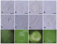 Figure 3. The intensity reactions of rat oocytes fed Anethum graveolens seed extracts that stained with different lectins. Oocyte after staining with UEA is shown in A: Sham group; B: Control group; C: Low dose of seed aqueous extract (LDE) treated group; D: High dose of seed aqueous extract (HDE) treated group. E-H illustreated the high magnifica-tions of A-D respectively. The intensity reactions of oocytes after staining with PNA in different groups were similar to UEA. DAB-FITC staining of control (J), LDE (K), HDE (L) treated groups. Negative control of DAB-FITC staining is shown in (I). Scale bars in first and third rows=15 µm and in second row=5 µm 
