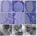 Figure 4. Light microscopic photograph of semi-thin sec-tions of oocytes and the corona radata follicular cells in  A: Control group; B: Low dose of seed aqueous extract (LDE) treated group; C: High dose of seed aqueous extract (HDE) treated group is shown in upper row. Middle row shows high magnifications of upper low respectively. Toluidine blue staining, scale bars=6 µm. Ultrastructure of follicular cells is illustreated in ultra-thin section of control (A), LDE (B) and HDE (C) treated groups. Each micrograph magnification is written on its side. Please note the large and dilated endo-plasmic reticulu in experimantal groups specially in HDE group. Uranyl acetate and lead citrate staining, scale bars=1 µm. ZP: Zona Pellucida; CR: Corona Radiata; O: Oocyte; N: Nucleus; ER: Endoplasmic Reticulum; NU: Nucleolus; L: Lysosyme
