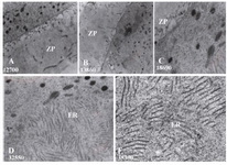 Figure 5. Photomicrograph of ultra-thin sections of oocytes and the zona pllucida in A: Control; B: LDE; C: HDE treated groups. High magnification of oocytes’ cytoplasm in control (D) and HDE treated groups (E). Uranyl acetate and lead citrate staining. Each micrograph’s magnification  is written in its left lower side ER: Endoplasmic Reticulum; V: Villi; ZP: Zona Pellucida