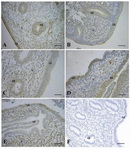 Figure 2. Immunohistochemical staining of human endometrium for VEGF. Endometrial tissues at the A: proliferative phase (days 7-12); B: peri-ovulatory phase (days 13-15); C: early-secretory phase (days 16-18); D: mid-secretory phase (days 19-21) and E: late-secretory phase (days 24-26). F: Negative control. LE: Luminal Epithelium; GE: Glandular Epi-thelium; S: Stroma. Original magnificationx40. Scale bar=50 μm. The red arrows indicate positive immunostaining