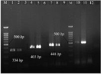 Figure 1. PCR products, electrophoresis gel of vaginal Mycoplasma (M= Marker, 100 bp, lines: 1,2 samples containing Mycoplasma hominis, lines 3, 6, 9, 12: negative control of sterilized distilled water, lines 4, 5: samples containing Ureaplasmaparvum, lines 7, 8: samples containing Ureaplasma urealyticum, and lines 10, 11: samples containing positive Mycoplasma genus
