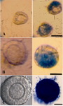 Figure 1. Trypan Blue staining for viability of follicles from vitrified ovarian tissues in different stages. A: Primordial follicles. B: Primary follicle; C: Secondary follicle. Scale bar=30 μm. In non-viable follicles, oocyte or the surrounding granulosa cells had blue coloration and viable ones were not stained