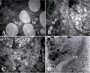 Figure 6. The electron micrograph of mithochondria (M) arrangement of secondary follicles. A: Numerous lipid droplets (L) are found in close association with atypical or irregularly shaped mithochondria with longitudinally oriented cristae in DCV 1-4 groups, TEM:x10000. B: Numerous elongated mithochondria with tubular-vesicular cristae in DCV 5-6 groups, TEM:x10000. C: Note the presence of numerous round mithocondria with continuous membranes and normal cristae and numerous parallel stacks of RER in DCV7 group, TEM:x7750, D: The zona pellucid (ZP) was fully developed and forming a thick layer around the oocyte of secondary follicle combination cryoprotectants. TEM:x10000