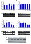 Figure 3. Effect of LPS on TLR4 and MyD88 expression in ESCs. ESCs were stimulated with different concentrations of LPS for 8 hr or with 100 ng/ml at different time intervals (2-24 hr) and the expression of TLR4; A, B: and MyD88 transcripts; C, D: was then assessed. Control wells received vehicle. Representative TLR4 and MyD88 PCR bands are shown at the bottom of each graph. E: Effect of LPS activation on TLR4 protein expression by ESCs was evaluated by Western blotting. ESCs1-3: Endometrial stromal cells from three representative participants.
 
AU: Arbitrary unit, *: p<0.05