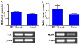 Figure 4. Effect of LPS on TLR4 and MyD88 gene expression in WECs. WECs were stimulated with LPS (100 ng/ml) for 8 hr and expression of TLR4; A: and MyD88; B: genes was then assayed by RT-PCR. Representative TLR4 and MyD88 PCR bands are shown at the bottom of each graph.
 
AU: Arbitrary unit, *: p<0.05
