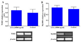 Figure 5. Effect of LTA on TLR2 and MyD88 gene expression in WECs. WECs were treated with LTA (10000 ng/ml) for 8 hr and expression of TLR2 and MyD88 genes was evaluated by RT-PCR. Representative TLR2 and MyD88 PCR bands are shown at the bottom of each graph.
 
AU: Arbitrary unit