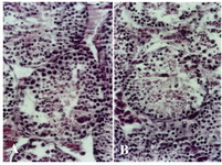 Figuer 2. Histological micrograph of seminiferous tubule in A: group 25 and B: 30 μM/kg, disorganization of cell layers in the tubules and presence of more pycnotic cells. Magnification 400