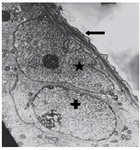 Figuer 3. Ultrastructural micrograph of seminiferous tubule in control group: myoepithelium (Arrow), nucleous of Sertoli cell (*) and a spermatogonia (+). Magnification of 4400
