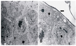 Figuer 4. Ultrastructural micrograph of seminiferous tubule in group of 15 μM/kg: myoepithelial (Arrow), nucleous of Sertoli cell (*) with vacuoles within the cytoplasm and spermatogonia (+). A: *3000 magnification; B: *4400 magnification