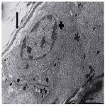 Figuer 5. Ultrastructural micrograph of seminiferous tubule in group of 15 μM/kg: myoepithelial (Arrow), spermatogonia with apoptotic nucleus (+). Magnification 4400