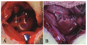 Figure 1. The photograph of cirsoid left vena spermatica vein in ELV model rat. A: control group, normal vena spermatica interna; B: ELV group, varicose vena