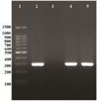 Figure 1. PCR test for Chlamydia trachomatis detection, lane (1) 100 bp DNA ladder (CinnaClon), lane (2) PCR positive control (300 bp), lane (3) negative control, lanes (4 and 5) positive PCR results (300 bp)