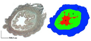 Figure 2. Lumen area, A: endometrial area; B: and total area (A+B+C) of the uterine (Masson’s trichrome) sections were measured using Dinocapture 2.0 software