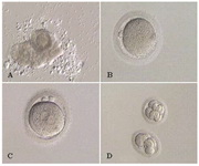 Figure 1. IVM laboratory course; A: Obtained GV oocyte with cumulus corona complex; B: MII oocyte following IVM; C: PN stage; D: Transferred embryo