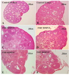 Figure 1. Photomicrographs of cultured and non-cultured mouse ovaries sections stained with hematoxylin and eosin: Micrographs of non-cultured; A: 14 day mouse ovary; B: 21 day mouse ovary, C: 14 day mice ovaries cultured without FSH and BMP15 (FSH-/BMP15-), D: cultured with FSH and without BMP15 (FSH+/BMP15-), E: cultured without FSH and F: with BMP15 (FSH-/BMP15+) and cultured with FSH and BMP15 (FSH+/BMP15+)
