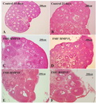 Figure 1. Photomicrographs of cultured and non-cultured mouse ovaries sections stained with hematoxylin and eosin: Micrographs of non-cultured; A: 14 day mouse ovary; B: 21 day mouse ovary, C: 14 day mice ovaries cultured without FSH and BMP15 (FSH-/BMP15-), D: cultured with FSH and without BMP15 (FSH+/BMP15-), E: cultured without FSH and F: with BMP15 (FSH-/BMP15+) and cultured with FSH and BMP15 (FSH+/BMP15+)
