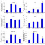 Figure 4. The expression ratio of FSHR, ZP3, CYP17, PCNA, BMPR-IB and BMPR-II to GAPDH in cultured mouse ovaries in the presence and absence of BMP15 and non-cultured groups, respectively; A-F: (a) significant difference with 14 day mouse ovary (p&lt;0.05), (b) significant difference with 1 day mouse ovary (p&lt;0.05) and (c) significant difference with FSH+/BMP- group (p&lt;0.05)
