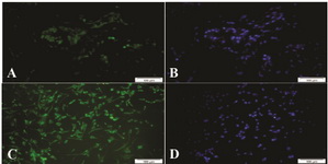 Figure 2. A, B: FSH receptor in human testicular tissue as a positive control: C, D: FSH receptor in cultured sertoli cells