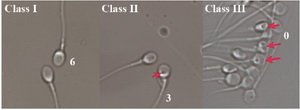 Figure 1. Spermatozoa at high magnification &times;6000 with the aid of MSOME. A. sperm with class 1 without vacuole. B. sperm with class 2 with small vacuole. C. sperm with class 3 with large or multiple vacuoles