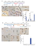 Figure 1. Cell proliferation in the luminal epithelium (LE). (A) The scheme of&nbsp; normal pregnancy. Normal pregnancy on day 3 (D3, B), D4 (C), and D5 (D) in ICR mice, and D5 (E) and D6 (F) in C57BL/6 mice. Pseudopregnant uteri on day 5 (pD5, G) and pD6 (H). (I) The cell proliferation rate during normal pregnancy. (J) Preparation of delayed implantation (DI) model mice. (K) Embryo (Em) apposing to the LE in DI mouse. The uteri of DI mouse injected with vehicle (L), 20 ng of estrogen (E2) (M), 25 mg leukemia inhibitory factor (LIF) (N), or 3 ng E2 (O). (P) The cell proliferation rate after treatment. St, stroma. Scale bar, 50 &mu;m