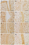Figure 3. Localization of progesterone receptors. (A) The uterus of delayed implantation (DI) mouse. The DI uteri treated with 20 ng estrogen (E2) (B), leukemia inhibitory factor (LIF) (C, D) or 3 ng E2 (E, F). The uteri in ovariecto-mized pseudopregnant mice 24 hr after injection with 20 ng of E2 (G), or LIF (H). LE, luminal epithelium; S, stroma. Scale bar, 50 &mu;m
