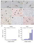 Figure 5. Cell proliferation in the luminal epithelium (LE) followed by treatment with recombinant protein to delayed implantation (DI) mice. The uteri of DI mice intraperitoneally injected with fibroblast growth factor 2 (FGF2, A), FGF9 (B), vehicle (C), or subcutaneously injected with insulin-like growth factor 1 (IGF1), (D, E, F, G and H) or vehicle (H, I). (J) Proliferating cell per unit area of the LE after injection with IGF1. Scale bar, 50 &mu;m
