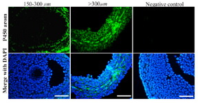 Figure 2. Immunohistochemical localization of aromatase cytochrome P450.
No or weak aromatase protein was noticed in early-small antral follicles (150-300 &micro;m; on the left), as a positive staining was evident in large antral follicles (&gt;300 &micro;m; in the middle). Control specimens did not exhibit any positive staining (on the right). Scale bars=50 &micro;m