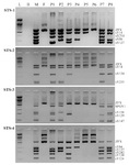 Figure 1. The microdeletion types of the azoospermia factor (AZF) regions in the Y chromosome by multiplex PCR analysis with STS markers. L: 100 bp DNA ladder; B: blank; M: male positive control, F: female negative control, P1: AZFa deleted patient; P2: AZFb deleted patient; P3: AZFc deleted patient; P4: AZFbc deleted patient; P5: AZFabc (Yq) deleted patient; P6: Yp(SRY)+Yq deleted patient; P7: partial AZFc (sY157 and sY158) deleted patient; P8: partial AZFc (sY254 and sY255) deleted patient