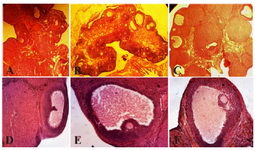 Figure 1. Histological analysis of normal ovaries (A, D) compared with PCOS (B, E) and ovaries treated with curcumin (C, F). The morphological changes of the rats&rsquo; ovarian tissues were stained with hematoxylin and eosin, as described in the Materials and Methods section. A, D) A representative rat&rsquo;s ovarian tissue section from the control group, which had normal appearance (A&acute;100,40). B, E) A representative rat&rsquo;s ovarian tissue section from the PCOS group showed thickening surface albuginea, under which there were many follicles in different phases (including atretic follicles and cystic dilating follicles), as well as fewer layers of granular cells, disappeared oocytes and corona radi-ating within the follicles (B&times;100, 40). C, F) A representative rat&rsquo;s ovarian tissue section from the group treated with cur-cumin, which showed increased granular cell layers, and some ovulation phenomena (C&times;100, 40) (Scale bar, 50 &mu;m A, B, C), (Scale bar, 20 &mu;m D, E, F). AF: atretic follicle, CF: cystic follicle (*), CL: corpus luteum, GCL: granular cell layer (∆), TCL: theca cell layer (&rarr;)
