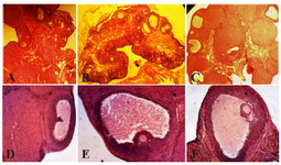 Figure 1. Histological analysis of normal ovaries (A, D) compared with PCOS (B, E) and ovaries treated with curcumin (C, F). The morphological changes of the rats&rsquo; ovarian tissues were stained with hematoxylin and eosin, as described in the Materials and Methods section. A, D) A representative rat&rsquo;s ovarian tissue section from the control group, which had normal appearance (A&acute;100,40). B, E) A representative rat&rsquo;s ovarian tissue section from the PCOS group showed thickening surface albuginea, under which there were many follicles in different phases (including atretic follicles and cystic dilating follicles), as well as fewer layers of granular cells, disappeared oocytes and corona radi-ating within the follicles (B&times;100, 40). C, F) A representative rat&rsquo;s ovarian tissue section from the group treated with cur-cumin, which showed increased granular cell layers, and some ovulation phenomena (C&times;100, 40) (Scale bar, 50 &mu;m A, B, C), (Scale bar, 20 &mu;m D, E, F). AF: atretic follicle, CF: cystic follicle (*), CL: corpus luteum, GCL: granular cell layer (∆), TCL: theca cell layer (&rarr;)
