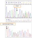 Figure 1. Novel mutations were identified in CFTR gene by sequencing