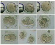 Figure 1. The morphology of oocytes and embryos derived from the infertile woman with an abnormal karyotype. Black arrows show SER cluster in the oocytes. Bar: 20 &micro;m